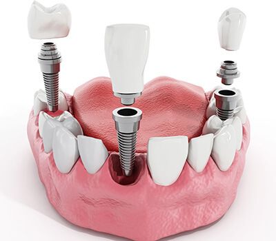 کلینیک دندانپزشکی راحیل