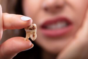 علت درد دندان چیست ؟