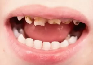 ترمیم و خدمات عمومی دندانپزشکی