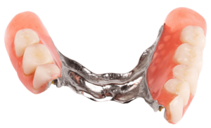 پروتز دندان چیست ؟