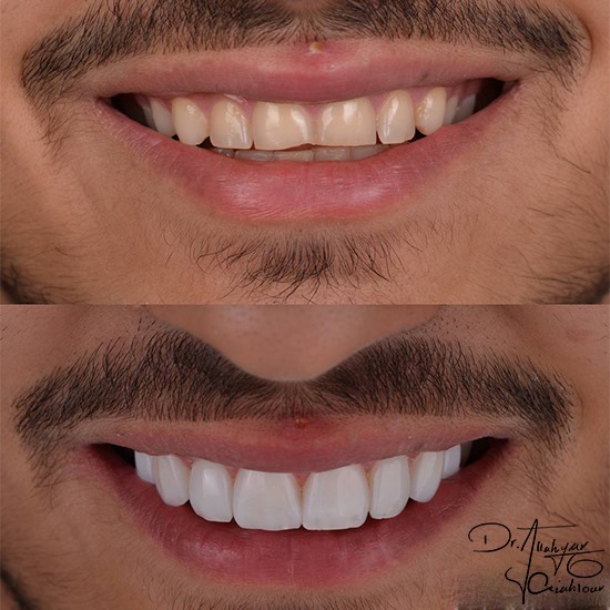 Untitlقل3434لed-1