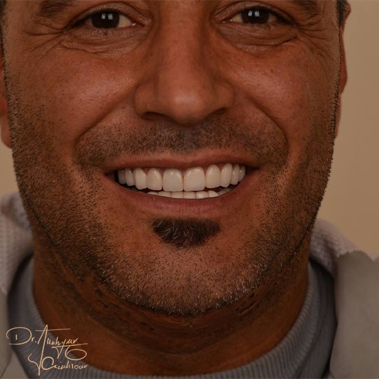 Untitقبرثقلبثضled-1