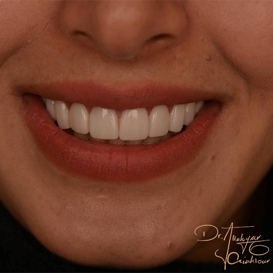 Untثبقثصبitled-1