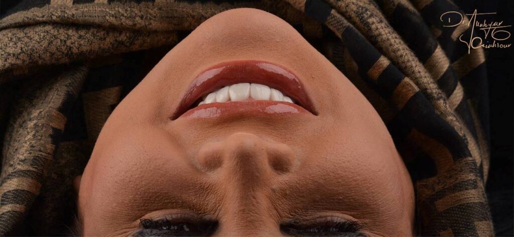 بهترین روش برای اصلاح طرح لبخند چیست؟