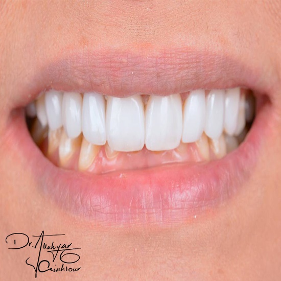 Uقثرلثقرلntitled-1