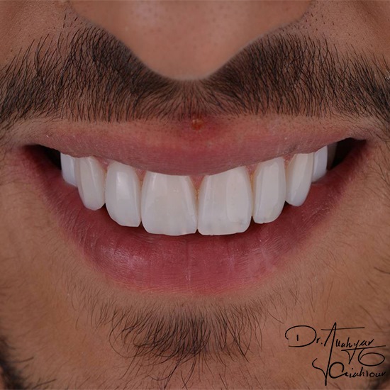 Uلب4قضق4لب34لntitled-1