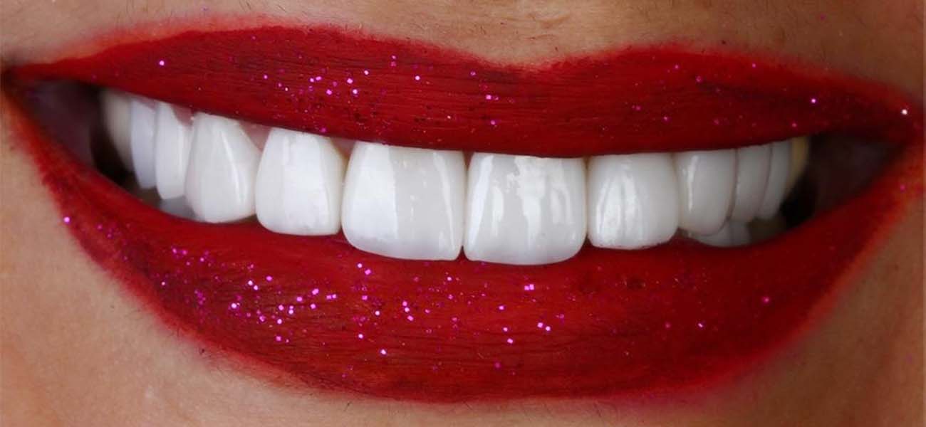 بهترین کلینیک لمینت دندان