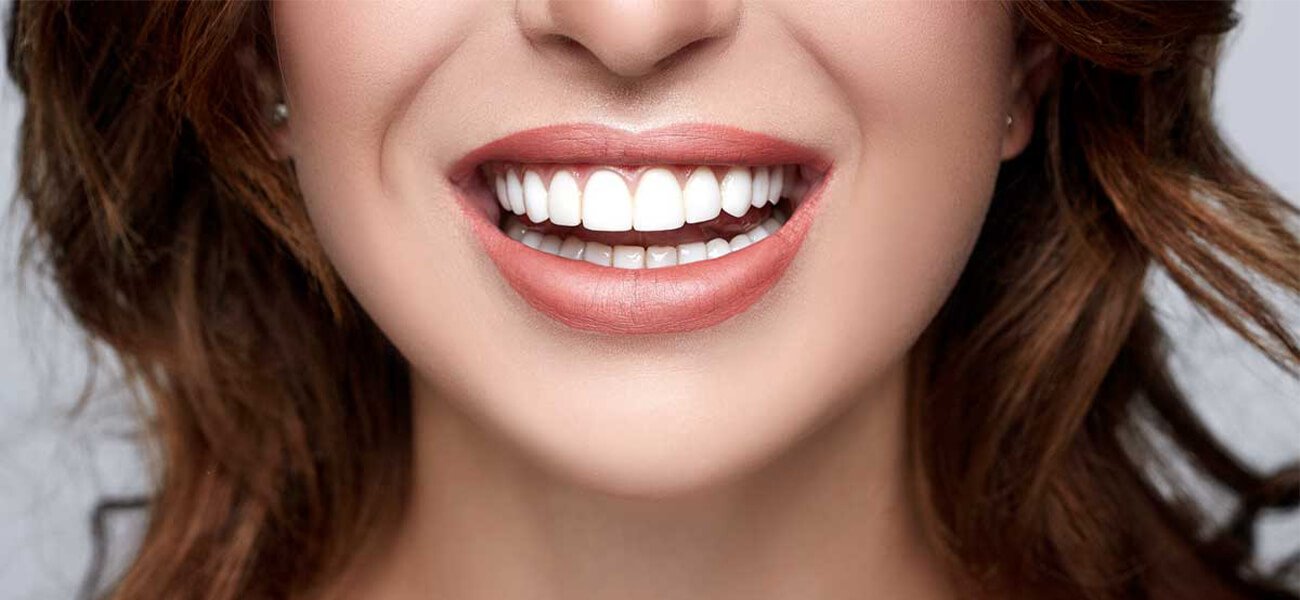 دندانپزشکی طراحی لبخند شمال تهران
