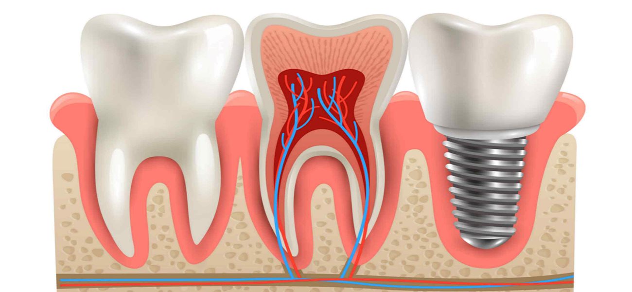 چرا معاینه منظم دندانپزشکی مهم است؟