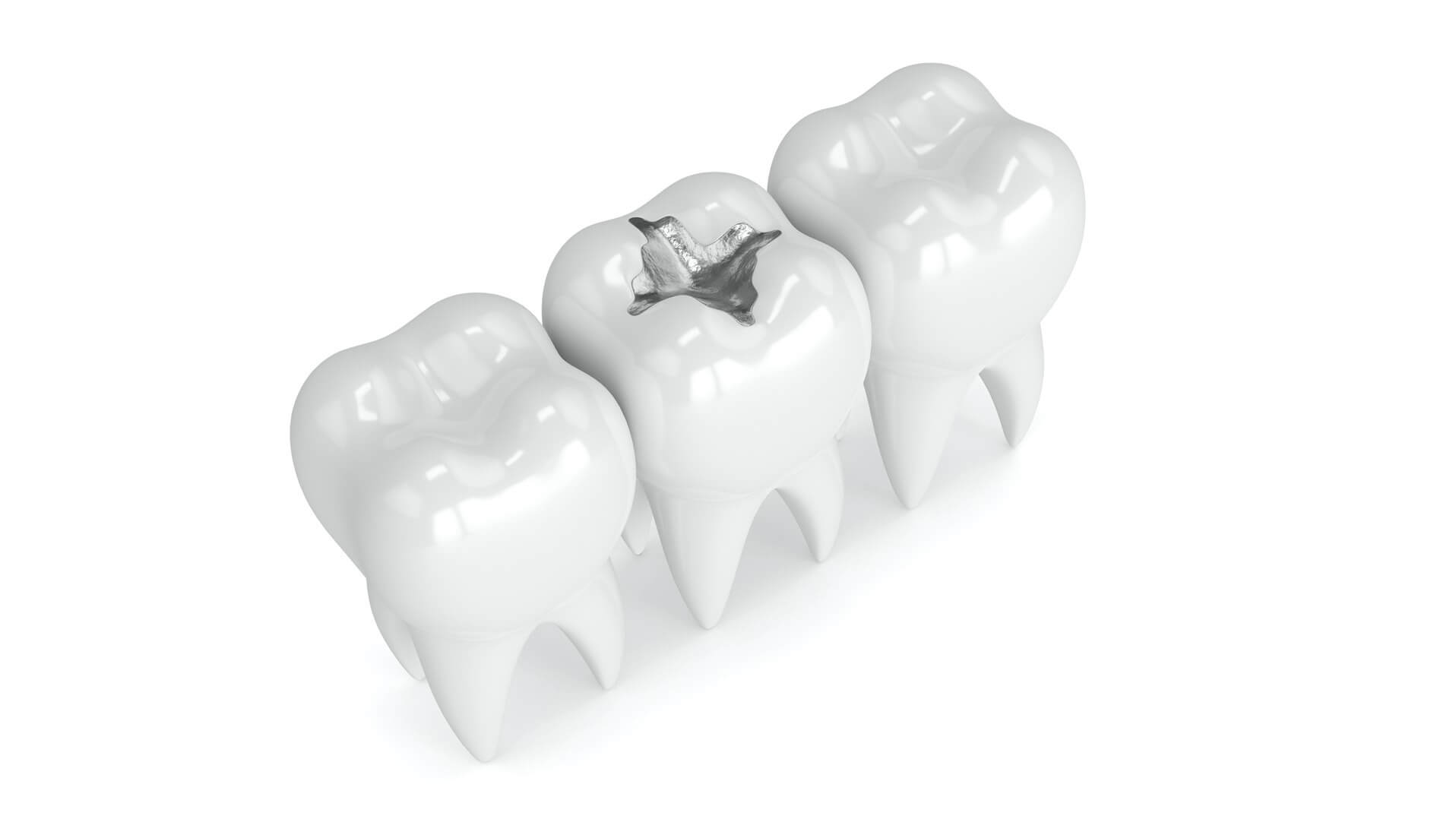 مرکز ترمیم دندان در شهرک غرب