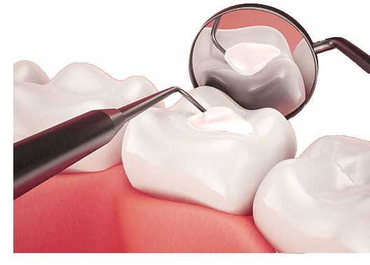 بهترین مواد ترمیمی دندان کدام است؟