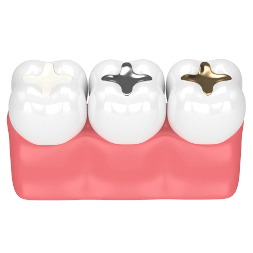 بهترین مواد ترمیمی دندان کدام است؟