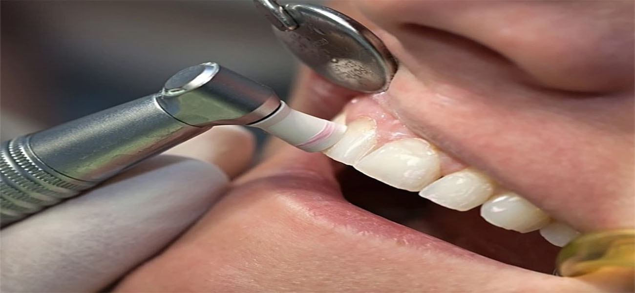 مرکز جرمگیری دندان