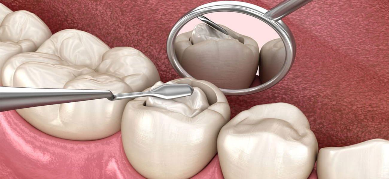 بهترین مرکز ترمیم دندان