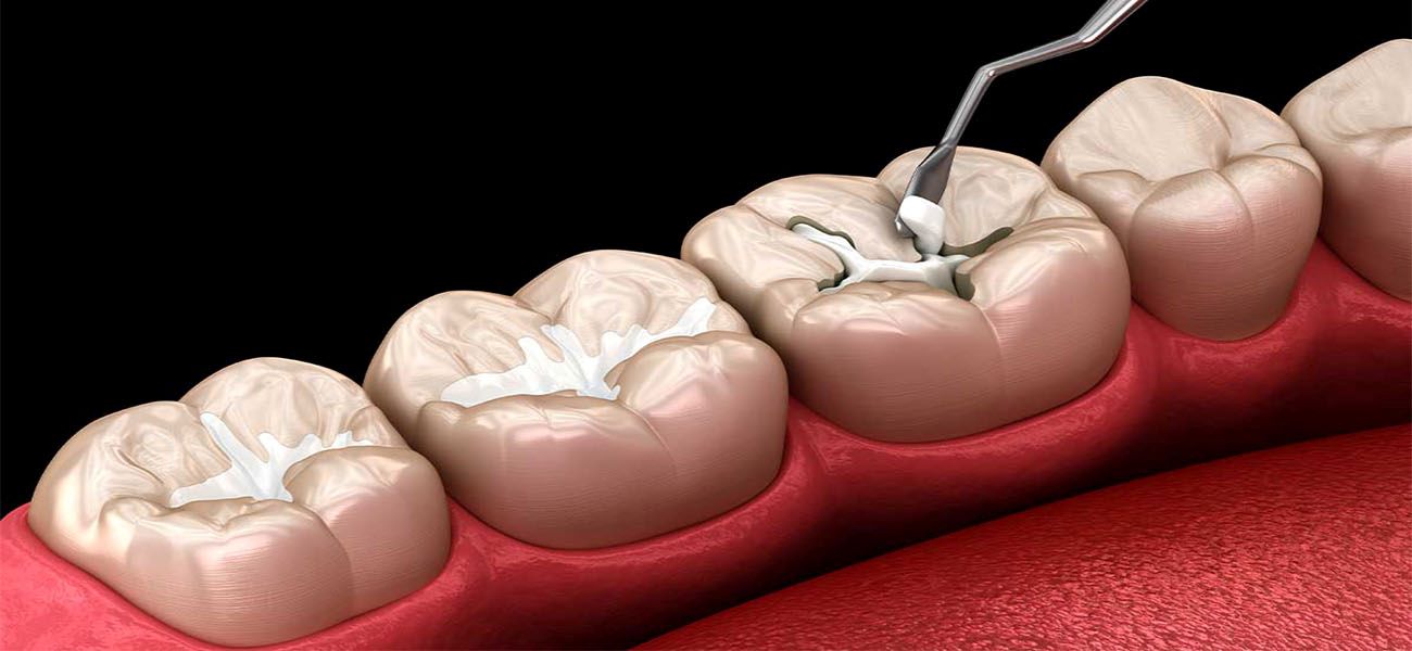 بهترین مرکز ترمیم دندان در سعادت آباد